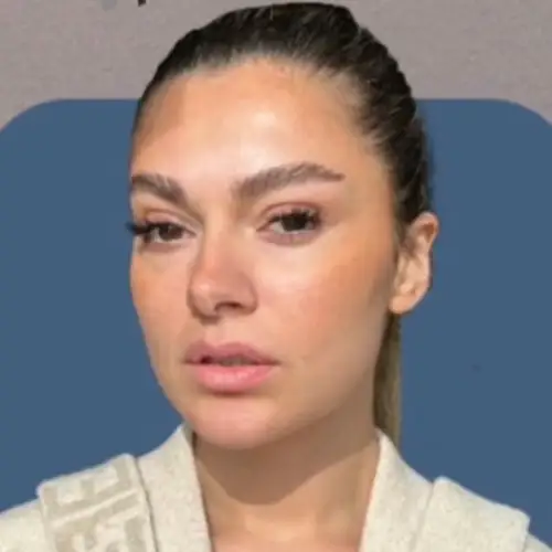 Mask-group Mask-group